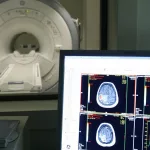 El ejercicio físico puede retrasar hasta siete años la aparición de síntomas de Alzheimer