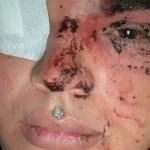 Miss Trans Zamora recibe una paliza en la que “casi pierde un ojo” de un grupo de entre 8 y 10 personas en La Bañeza (León)