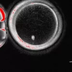 Consiguen por primera vez generar óvulos humanos potencialmente fecundables a partir de células de la piel