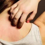 Día Mundial de la Alergia: ¿por qué se conmemora el 8 de julio?