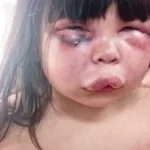 Feroz golpiza a una nena en Gerli: la atacó su padrastro y fue detenido