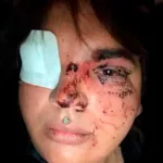 Salvaje agresión en León: una decena de personas apalea a Miss Trans Zamora 2024