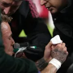 Un jugador del Galatasaray sufrió una escalofriante lesión ante el Liverpool que casi le cuesta el dedo