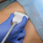 El Gobierno desreguló la importación de equipamiento médico usado y reacondicionado