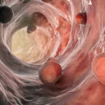 Harán un test muy sencillo en puestos callejeros para prevenir el segundo cáncer más frecuente