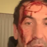 Asaltaron y golpearon a Pablo Cervi, candidato libertario en Neuquén, a horas de las elecciones