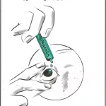 El Roto: el oftalmólogo