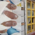 “Tiene el 95% de la mano destruida”: una ventana cayó sobre un niño y la familia denunció que las instalaciones escolares estaban en mal estado