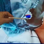 La cirugía del futuro ya se hace en un hospital público de Coghlan: cómo se opera con realidad aumentada