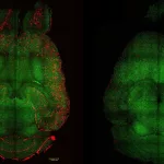Científicos logran revertir el Alzheimer en ratones restaurando la barrera hematoencefálica