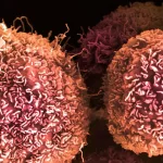 Una idea imposible derivó en un gran avance contra el cáncer de páncreas