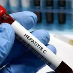 Día Mundial contra la Hepatitis: ¿por qué se conmemora cada 28 de julio?