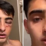 Salvaje ataque en patota de un grupo de rugbiers a un joven de 19 años a la salida de un boliche en Tucumán: “No me puedo mover”