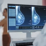 Cambian la edad a partir de la cual las mujeres bonaerenses deben hacerse la mamografía contra el cáncer de mama