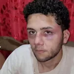 El accidente laboral que se convirtió en un calvario: sus empleadores lo atacaron brutalmente para no pagarle