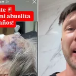 Un influencer que critica suplementos dietarios denunció amenazas: dice que golpearon a su abuela pero no ratificó sus dichos a la policía