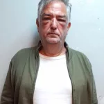 ANDIS: un abogado de la Oficina Anticorrupción es abogado de Calvete y se presentó cuando fue allanado